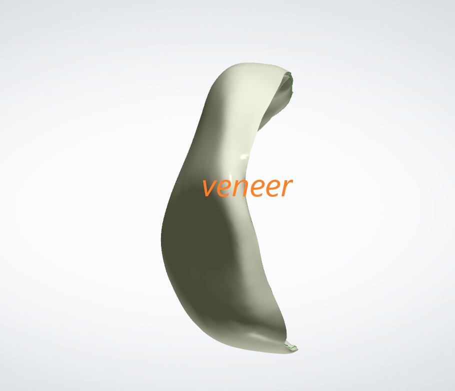 veneer